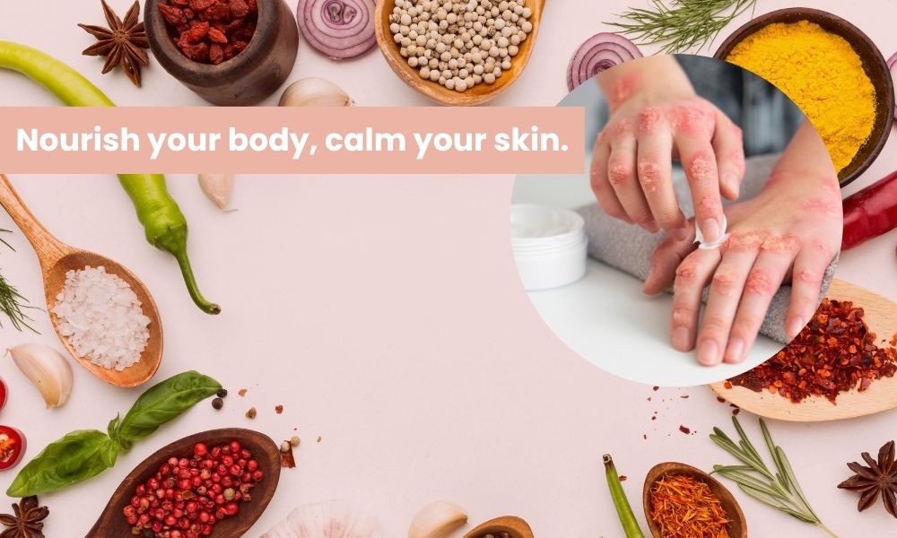 Can Diet Help Psoriasis