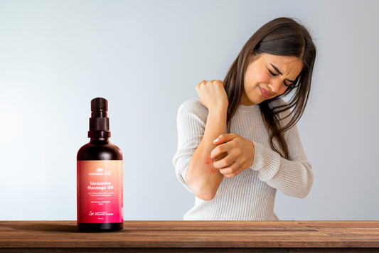 Common Psoriasis Myths