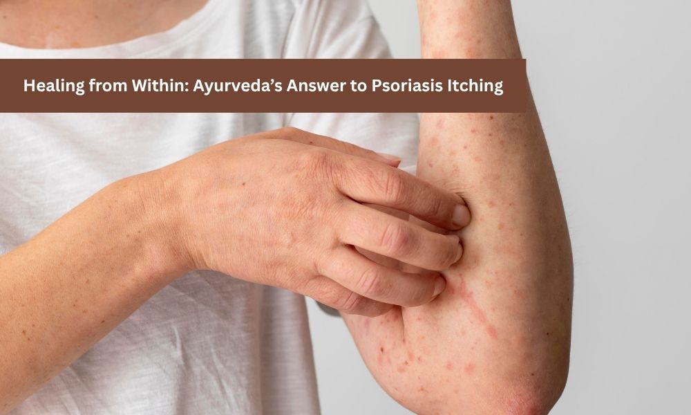 Does Psoriasis Itch? Causes, Triggers & Ayurvedic Tips