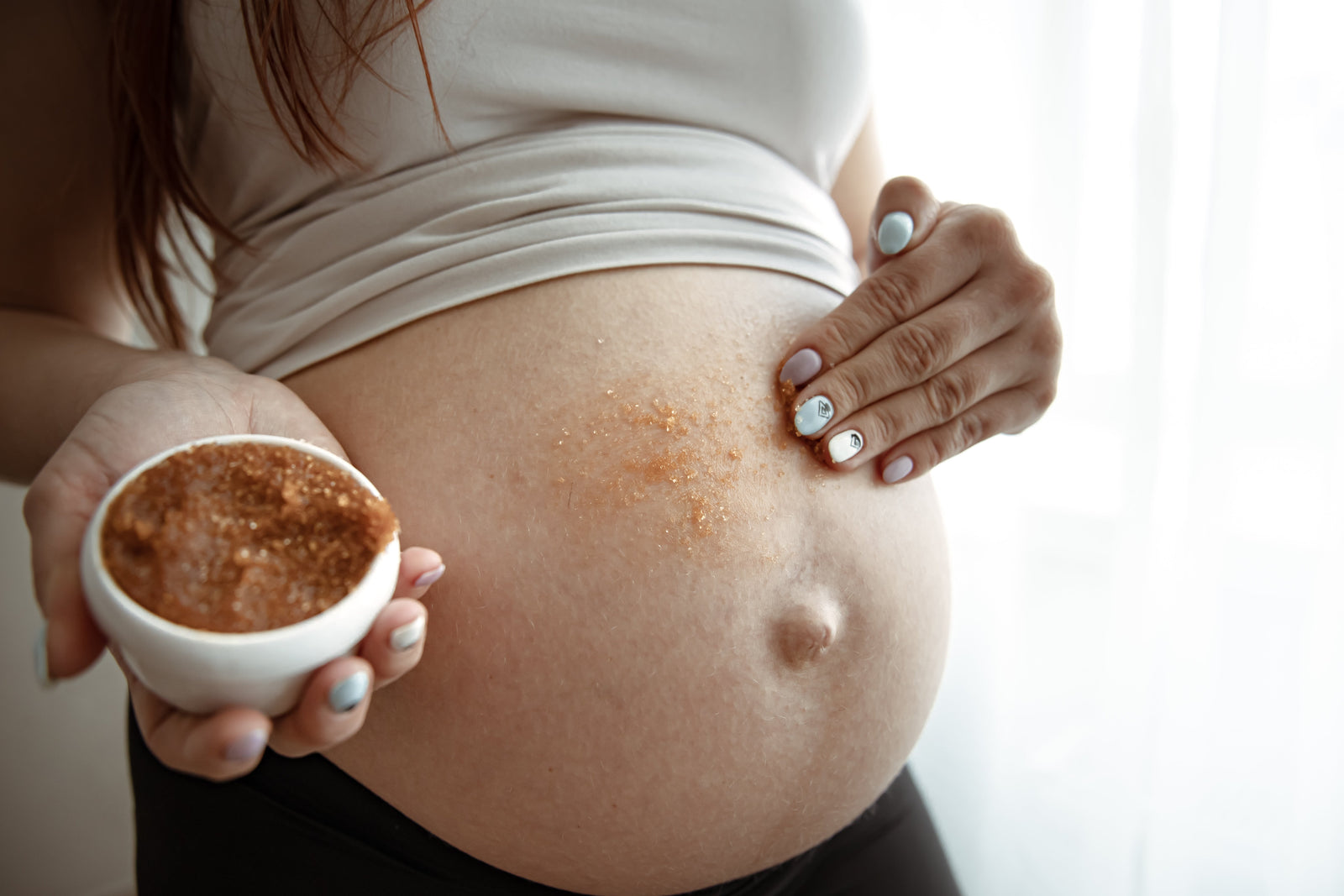 Managing Psoriasis During Pregnancy
