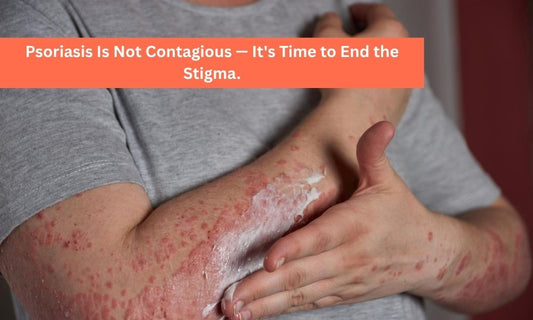 Can Psoriasis Spread by Touch?
