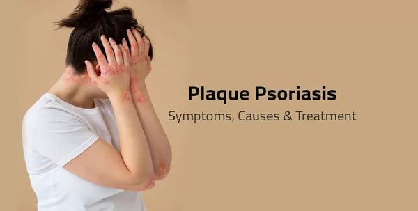 Ayurveda's View on Psoriasis: Causes, Symptoms and Treatment